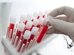 پالایشگاه پلاسما