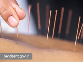 طب مکمل چینی